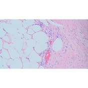 Tissue Control Slide, Giemsa